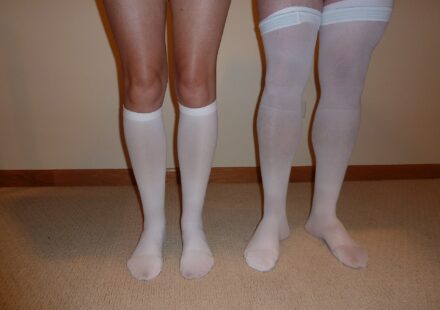 Knee-high and thigh-high anti-embolism compression stockings laid out for comparison