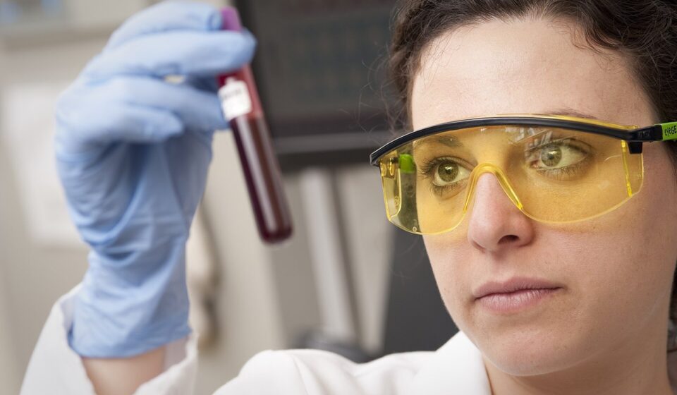 Does Medicare Cover Blood Tests? What Part B Pays, Screening Limits, and When You Get a Bill Lab technician holding up a blood sample tube to check it