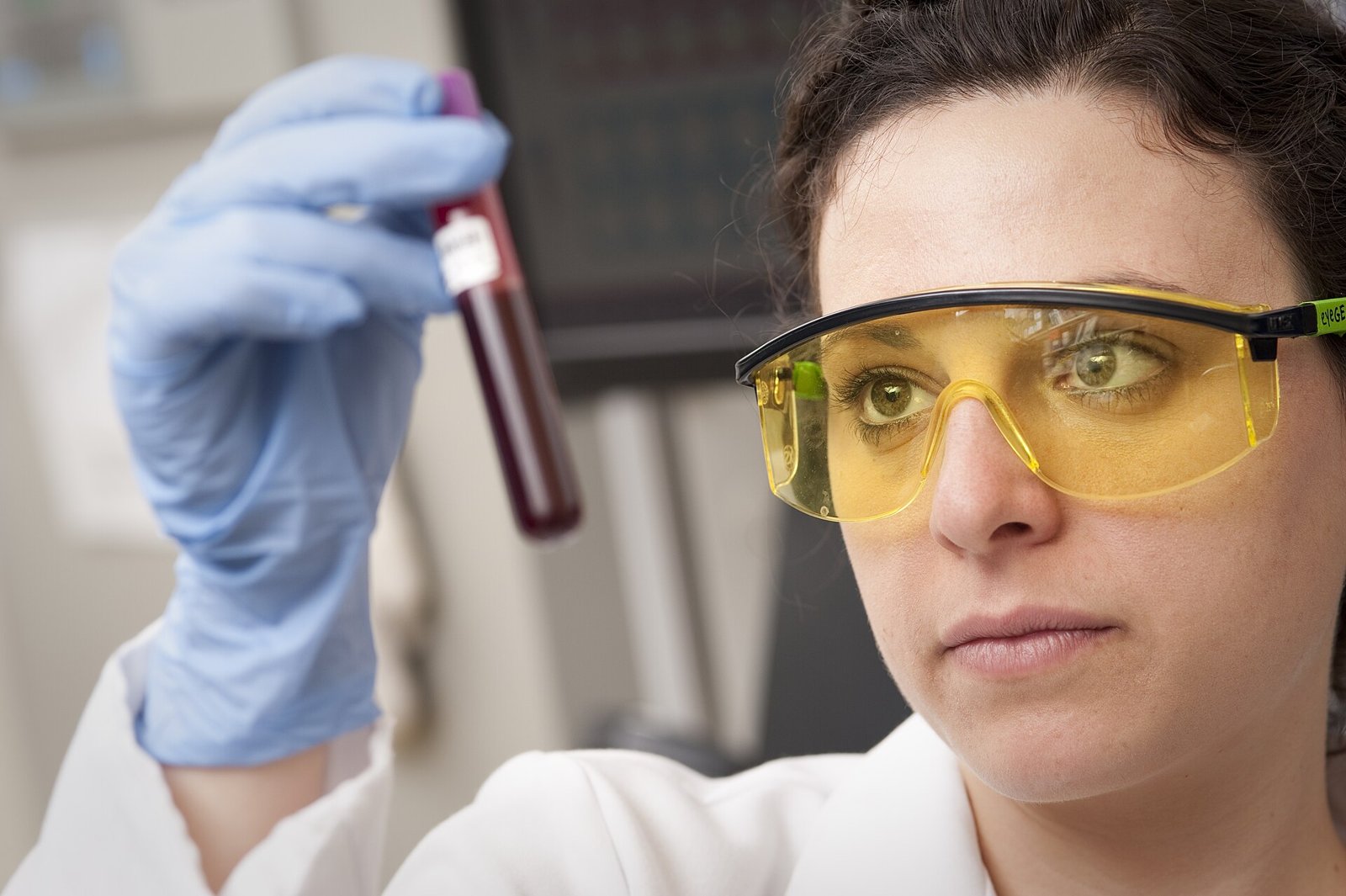 Lab technician checking a blood sample