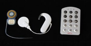 The parts of a cochlear implant system: the internal implant, the behind-the-ear sound processor and a remote control
